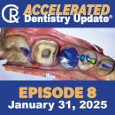 Accelerated Dentistry Update, Episode 8, Jan 31