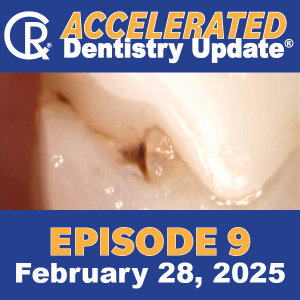 Accelerated Dentistry Update, Episode 9, February 28, 2025