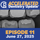 Accelerated Dentistry Update, Episode 11, June 27, 2025