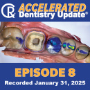 Accelerated Video Episode 8 Recorded 31Jan25